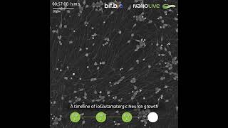 A timeline of ioGlutamateric Neurons [upl. by Airetnahs]