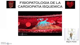 Fisiopatologia De la Cardiopatia Isquemica [upl. by Nore628]