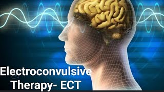 ECT Electroconvulsive therapyبرقی علاج [upl. by Ahola857]