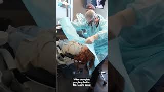 Gengivoplastia com osteotomia  facetas em resina composta [upl. by Allcot]