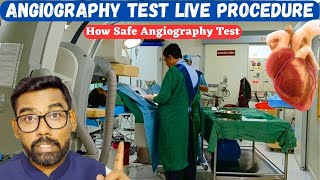 Unbelievable Live Angiography  Angiography Video  Angiogram [upl. by Nohsed]