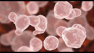 Cryptococcus Neoformans Infection [upl. by Raine]