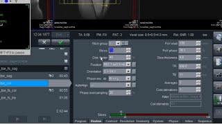 MR  Emar  Teknik Ayarlar 1Bölüm  Slices NedirFov Nedir SNR Nedir Magnetic Resonance Bilgiler [upl. by Neztnaj]