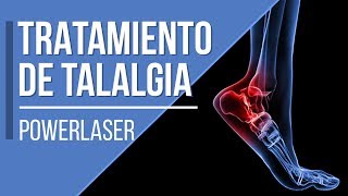 Tratamiento de Talalgia  PowerLaser [upl. by Anahpos]