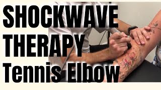 SHOCKWAVE Treatment for Tennis Elbow San Diego [upl. by Aciretnahs]