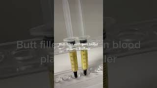 Biofiller Liquid BBL  Butt amp Hip Filler using own blood Plasma [upl. by Ami754]