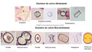 Taller Integrativo Curso Uroanálisis y Sedimento Urinario [upl. by Pauline317]