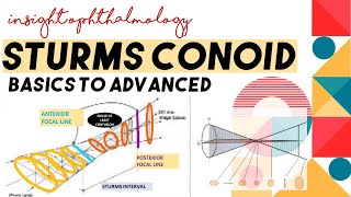 STURMS CONOID  APPLICATIONS AND CONCEPT  Types of astigmatism through sturms conoid [upl. by Waring]