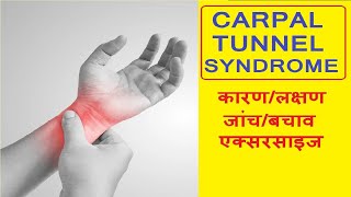 Carpal tunnel syndrome in hindi  carpal tunnel syndrome kya hota hai carpal tunnel exercise [upl. by Hefter50]