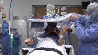 Violinist Still Making Music After DBS Surgery  Mayo Clinic [upl. by Teak]