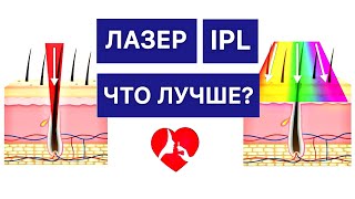 ЛАЗЕР ИЛИ ФОТОТЕРАПИЯ IPL ЧТО ЛУЧШЕ  ЧЕСТНЫЙ ОТВЕТ КОСМЕТОЛОГА [upl. by Anamuj378]