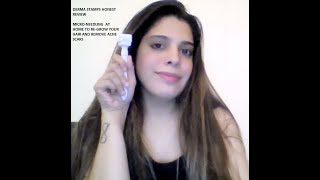 DERMA STAMPYAY OR NAY nonsponsoredreview honestreview hairgrowth microneedling skincare [upl. by Bagley]