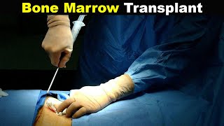 Bone Marrow Transplant  Allogeneic stem cell transplant  Nursing Study in Hindi [upl. by Dhumma]