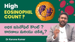 Reasons for High Eosinophil Counts  How to Reduce Eosinophils  Dr Karuna Kumar Hematologist [upl. by Alekin43]