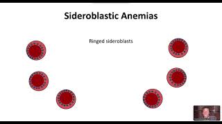 Sideroblastic Anemias [upl. by Nadabb]