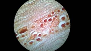 Histología del Sistema Nervioso [upl. by Eugatnom]