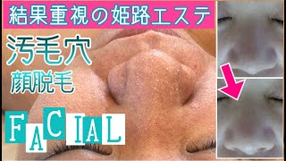 【毛穴詰まり！フェイシャル】毛穴を綺麗に！毛穴クリーンでピカピカお肌と顔脱毛 [upl. by Elery]