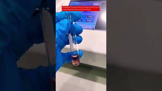 Cholesterol testing bloodchemistry laboratory medtechstudent cls mls [upl. by Chappie826]