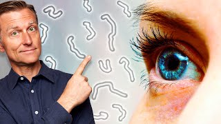 What Causes Eye Floaters and Dry Eyes [upl. by Noyar]