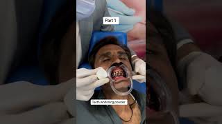 Part 1 teeth whitening jubinnautiyal song bollywood music love teethwhiteningproducts [upl. by Ueik461]