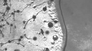 A colony of Dictyostelium devouring bacteria [upl. by Lawrenson723]