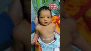 Neonatal Jaundice Treatment niculife cutebaby newbornbaby nicunursehospital jaundicetreatment [upl. by Kiersten]