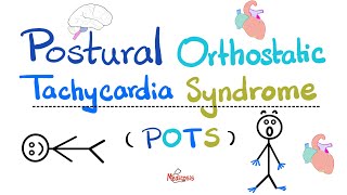 Postural Orthostatic Tachycardia Syndrome POTS  Causes Symptoms Diagnosis TreatmentCardiology [upl. by Eberle]