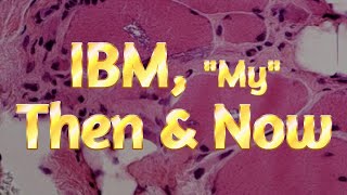 IB Myositis  120 IBM My Then amp Now [upl. by Elletnahc517]