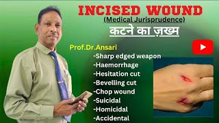 Incised wound  Haemorrhage  Chop wound  Suicidal  Homicidal  Accidental  Hesitation cut [upl. by Onnem]