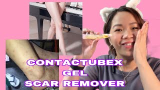 PAANO GAMITIN ANG CONTRACTUBEX GEL SCAR REMOVER UPDATE [upl. by Suivatco231]