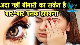 मुश्किल का संकेत हो सकता है बारबार पलक झपकना जानें इसके बारें में Reason for Eye Blink [upl. by Aimej]