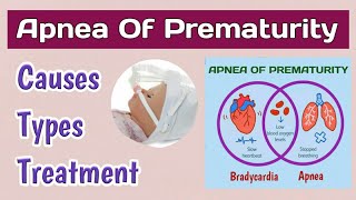 Apnea Of Prematurity  Apnea In Premature Babies  Breathing Problems In Newborns [upl. by Navap]