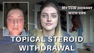 How I healed from TSW and Eczema  My Topical steroid withdrawal journey with tips and pictures [upl. by Hadihahs]