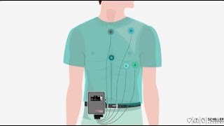 SCHILLER lenregistrement ambulatoire de lECG  Holter ECG [upl. by Egerton]