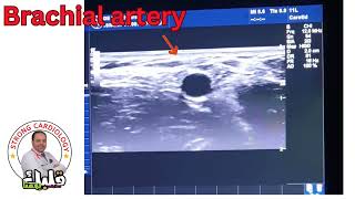 Arterial pulsation examination importatnt Tip Dr Alaa Nasr 2024 [upl. by Nizam37]