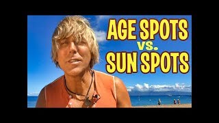 AGE SPOTS or SUN SPOTS on Skin How to Get Rid of Them [upl. by Terzas]