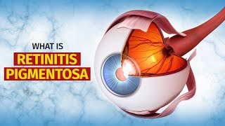 What is Retinitis Pigmentosa RP  Symptoms Treatment and More [upl. by Burnham]