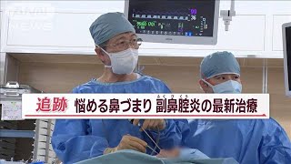 痛い手術…驚きの器具で進化 「副鼻腔炎」患者200万人 患者負担減らす最新“鼻”治療【Jの追跡】2023年7月16日 [upl. by Sophie]