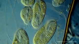 Various Ciliated Protozoa Kingdom Protista DIC Lighting Technique [upl. by Netsriik625]