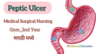 PEPTIC ULCER  GASTRIC ULCER STOMACH DISEASE  MEDICAL SURGICAL NURSING  MARATHI NURSING [upl. by Anelra]