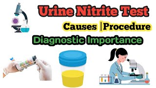 Urine Nitrite Test  Procedure  Diagnostic Importance  Causes [upl. by Erida]