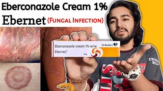 Ebernet Cream Review  Eberconazole Cream 1 For Ringworm Itching Fungal Infection [upl. by Oirramed211]