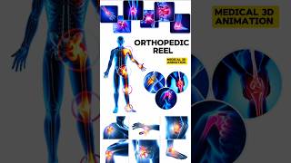 Orthopedic Reel medical animation 3d short BiologywithAliya [upl. by Ramar462]