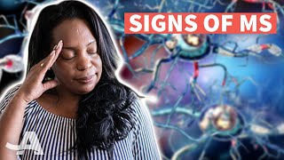 Early Signs of Multiple Sclerosis [upl. by Anahsar]