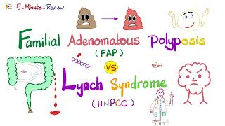 FAP vs Lynch Familial Adenomatous Polyposis vs Hereditary Nonpolyposis Colorectal cancer Oncology [upl. by Lytsirk711]