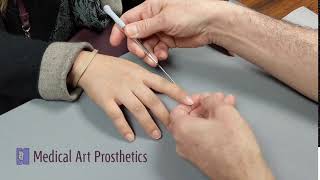 Silicone Finger Prosthesis demonstrating ease of use [upl. by Longawa]