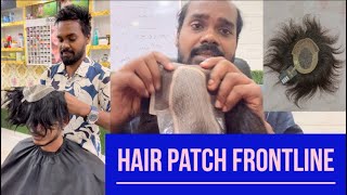 Frontless hair patch Frontline hair patch Premium quality hair patchhairpatchinkolkata [upl. by Amaty127]