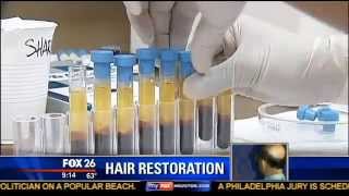 ACell  PRP Stem Cell Hair Regrowth Treatment  Houston Hair Surgeon Dr Dan McGrath [upl. by Enyledam7]