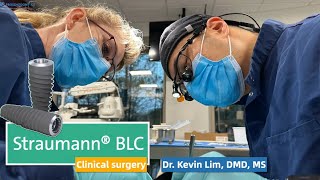 Straumann BLC guided surgery by Dr Kevin Lim DMD MS StraumannGlobal CaryProsthodontics BLC [upl. by Sathrum]