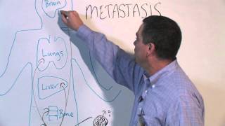 How Cancer Spreads Metastasis  Michael Henry PhD [upl. by Zertnom]